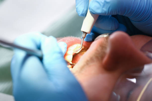 Best Pediatric Emergency Dentist in Ogdensburg, NY
