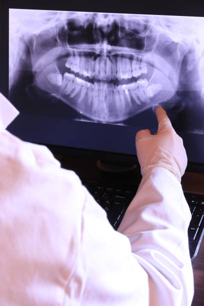 Best Weekend Emergency Dentist in Ogdensburg, NY
