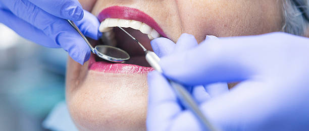 Best Urgent Care for Lost Fillings or Crowns in Ogdensburg, NY